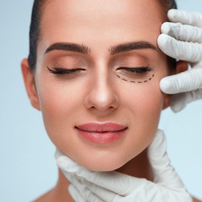 Blefaroplastia-Inferior