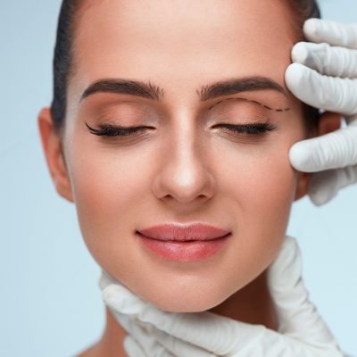 Blefaroplastia-Superior