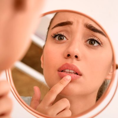 Queiloplastia